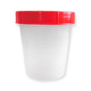 FRASCO COLECTOR  DE ORINA DE  100  ML  ESTERIL